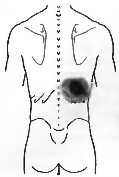 Болит спина отдает в ребра справа. Ребра со стороны спины. Правая сторона спины. Боль в спине справа. Слева внизу спины.