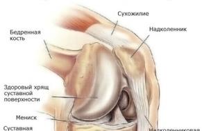 Методи обстеження колінного суглоба