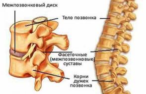 Osteokondrose av cervical ryggraden - symptomer og behandling